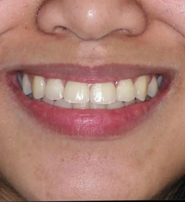 orto2.webp