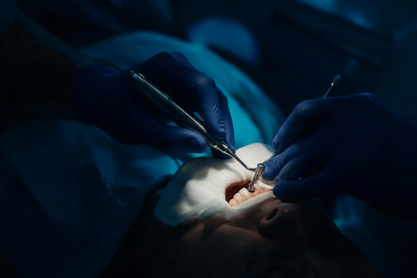 Fotografia em estilo editorial, close-up das mãos enluvadas de um dentista segurando com cuidado um instrumento próximo à boca de um paciente